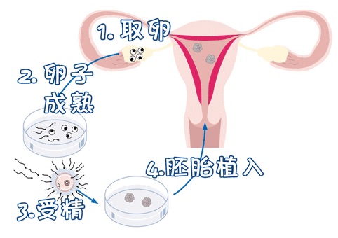 关于暖阳生殖